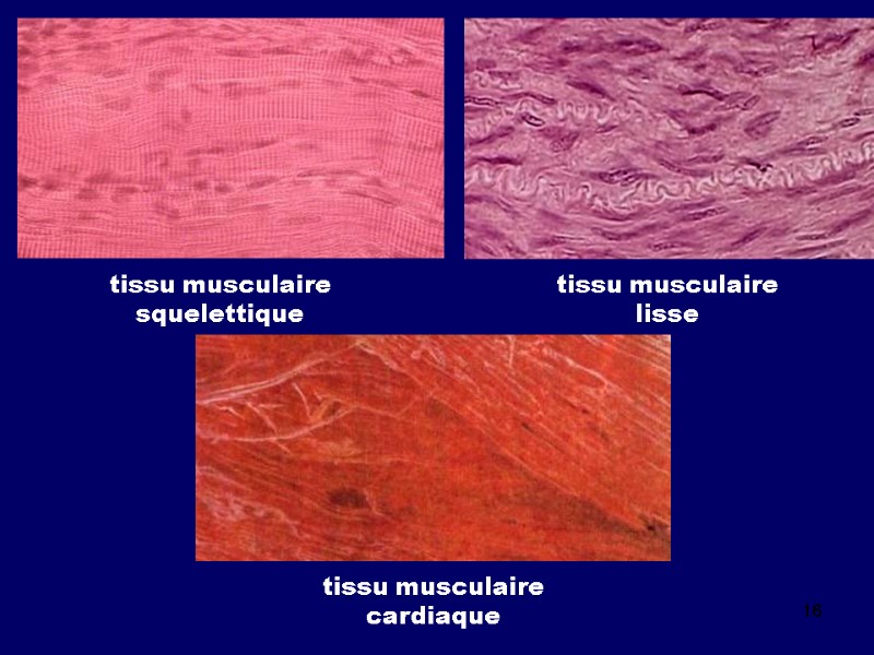 16 tissu musculaire squelettique tissu musculaire lisse tissu musculaire cardiaque